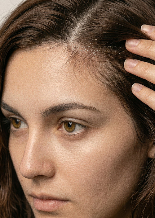 Scalp Care (Dandruff)