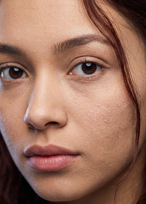 Deep Hydration (Dry Skin)